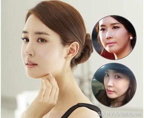 整完容真的美吗?明星整容前后对比图,没对比没伤害!
