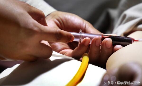 22岁下身剧痛，脱下裤子的一瞬间，医生抽出了一大管积血！