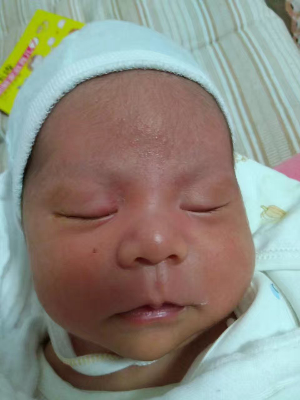 宝宝湿疹反复怎么办教你一招去除,宝宝湿疹反复怎么消除又快又好