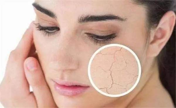 用硫磺皂洗脸就可以祛粉刺，这是真的吗？