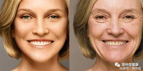 你知道脸上有皱纹是什么原因吗,你知道衰老的根本原因么