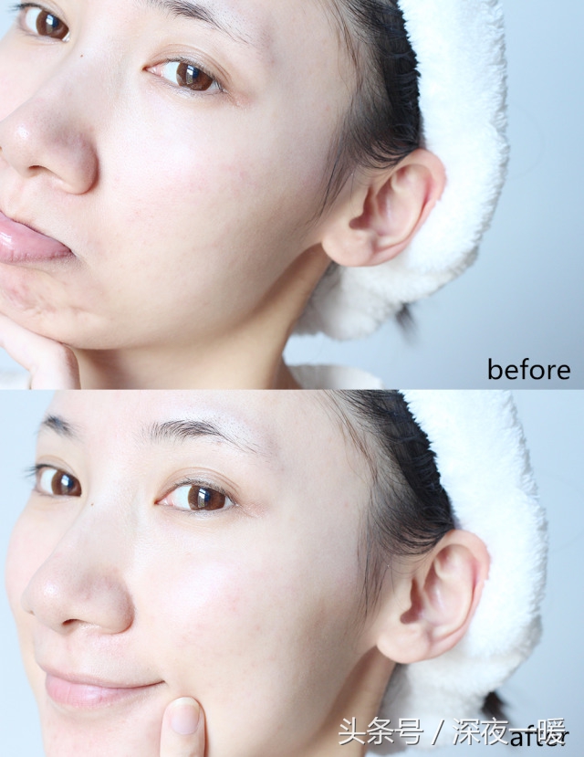 雅诗兰黛红石榴水哪个适合夏天用,红石榴水雅诗兰黛油皮