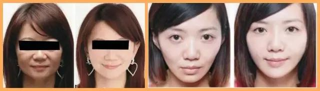 最靠谱的除皱产品,什么除皱效果好又平价