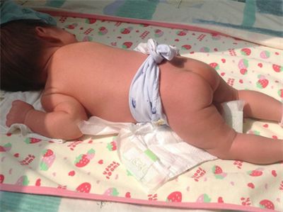 宝宝黄疸12.5!医生要求照蓝光没答应,在家做了几件事,三天退疸!