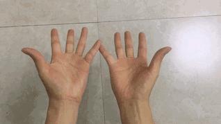 手肿手指麻木怎么缓解,手指麻手胀疼怎么解决