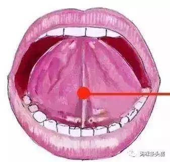 宝宝吐字不清训练方法,怎么样判断宝宝说话不清舌系带短