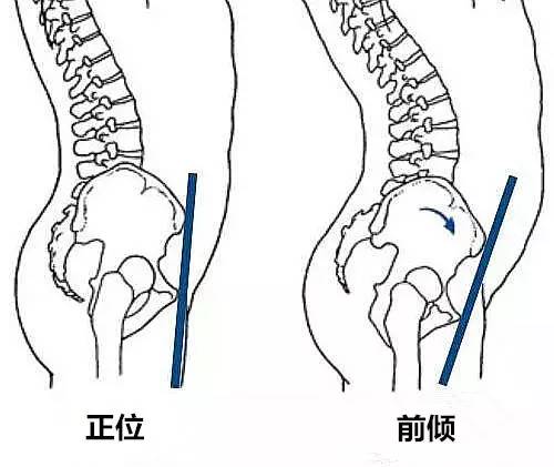 骨盆哪个位置最重要,骨盆在哪个位置最好