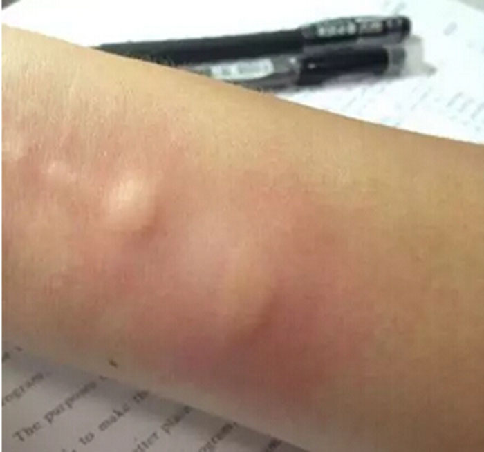 令人恐怖的农业害虫,农村惹人厌的植物