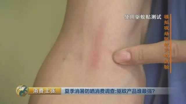 夏天宝宝驱蚊的正确方法,夏天婴儿驱蚊的正确方法