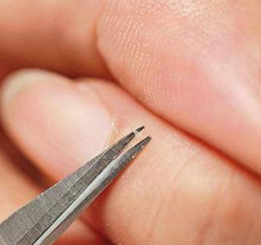 指甲旁边倒刺如何消灭,婴儿指甲旁边长倒刺