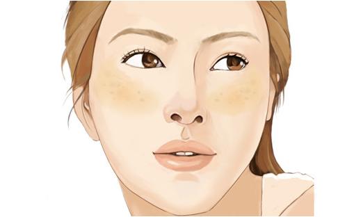 43岁女人脸上的黑褐斑怎么去除,脸上的黄褐斑点怎么去除