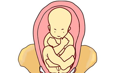 胎位不正怎么纠正最安全,骨缝开了胎位不正有什么方法矫正