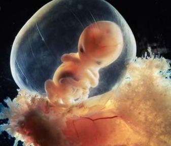 孕早期胎停有什么反应和症状,孕早期出现胎停会有什么症状