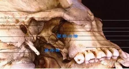 口腔拔牙图片,口腔拔牙麻醉多久消退