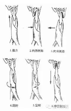 口腔拔牙图片,口腔拔牙麻醉多久消退