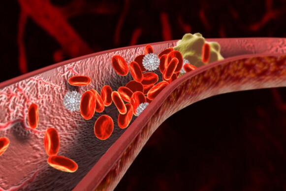 血栓的危害视频,血栓的危害和风险