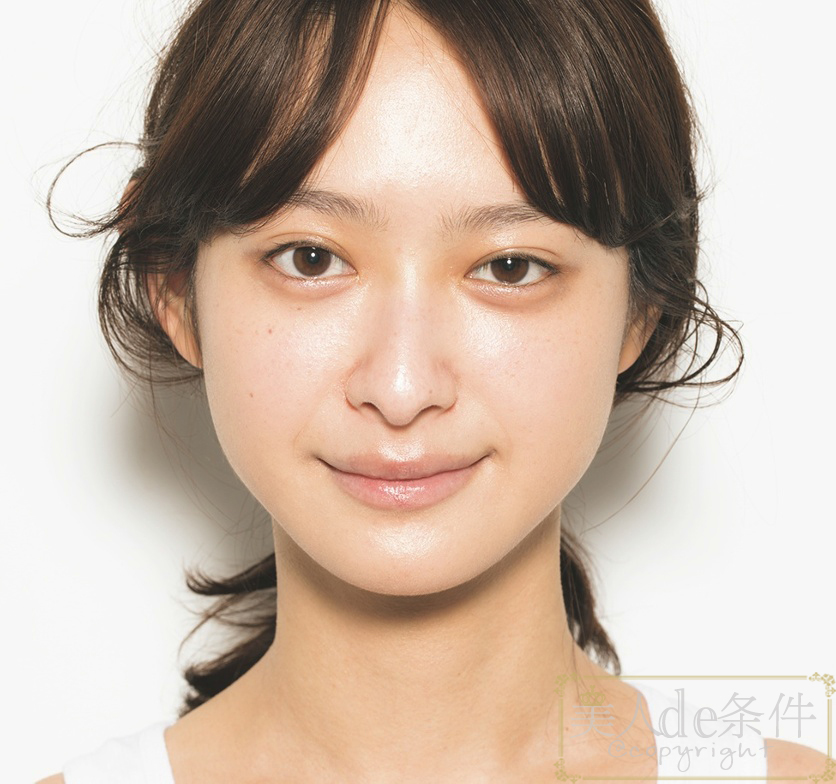 眉头太低打玻尿酸怎么能提上去,经常皱眉要不要打玻尿酸