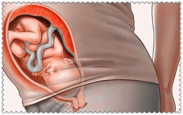 40周见红没入盆能顺利顺产吗,40周5还没入盆顺产几率