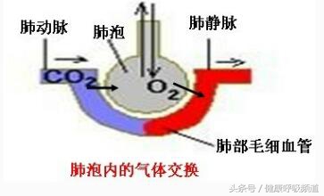 肺心病患者肺内二氧化碳太多，该怎么办？
