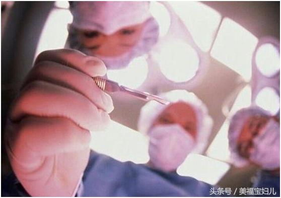 我为自己辟谣!告诉你会阴到底该不该切