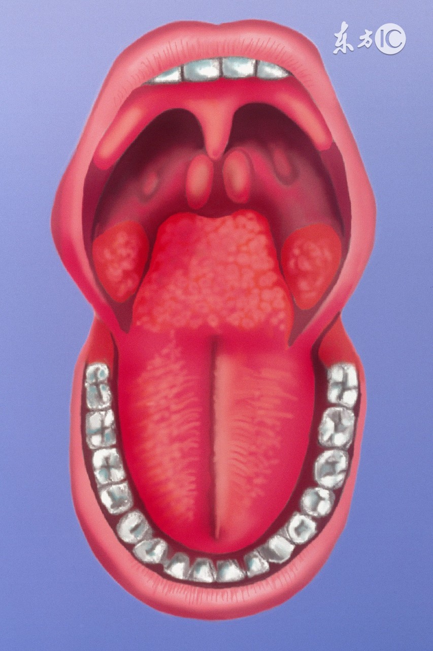 扁桃体能割一边吗,扁桃体能回缩吗
