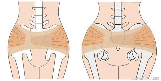 备孕腰椎间盘突出怎么办,腰椎间盘突出可以备孕吗