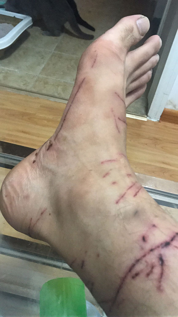 男子晒出被猫妈抓挠的伤痕，网友看后一阵大笑：没咬你算轻的！