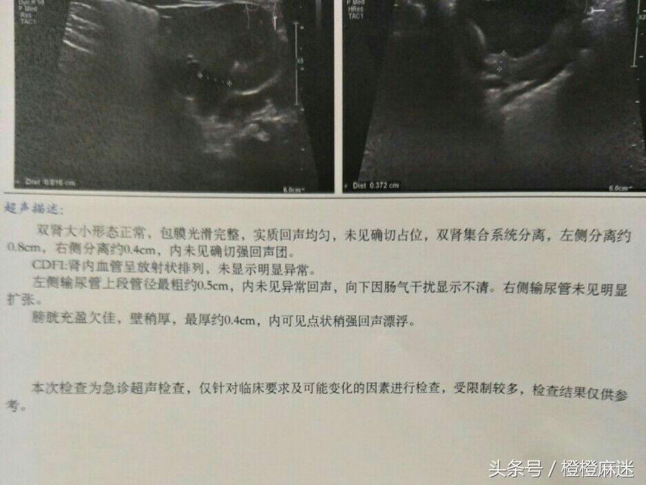 8个月宝宝尿路感染最快自愈法,四个月的宝宝尿路感染怎么处理