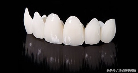 打桩后做的全瓷牙寿命是多久,韩国奥齿泰全瓷牙一般寿命多少年