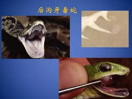 原来，这些救治毒蛇咬伤的方法都不靠谱