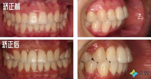 医生郭涛,正畸郭涛