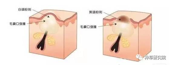 怎么让皮肤像剥壳鸡蛋一样光滑,怎么让皮肤滑的像鸡蛋