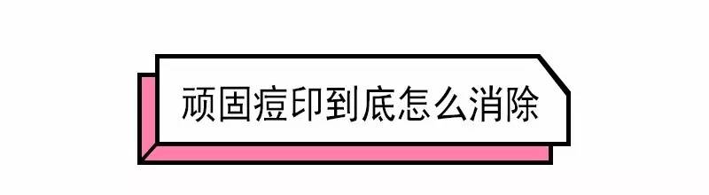 痘痘肌怎么消炎清理毛孔,控油祛痘痘的最佳方法