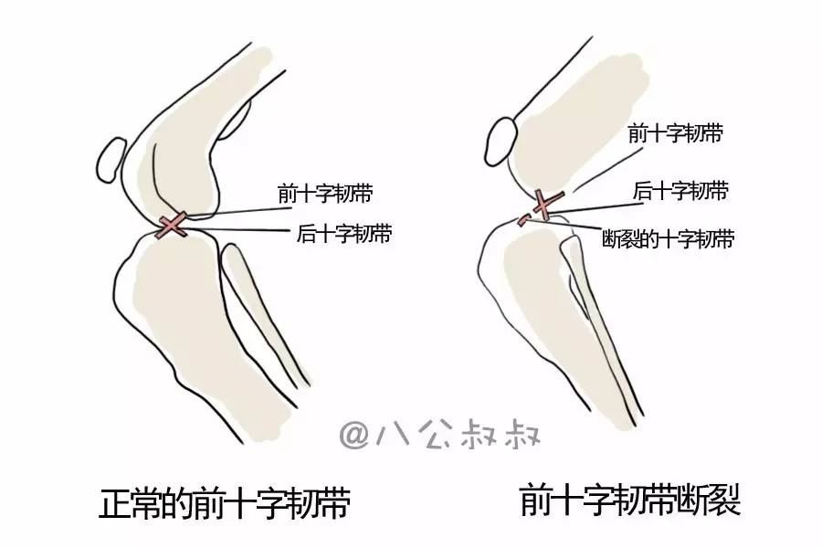 狗狗得关节炎常见的症状有哪些,狗狗膝关节最佳治疗方法