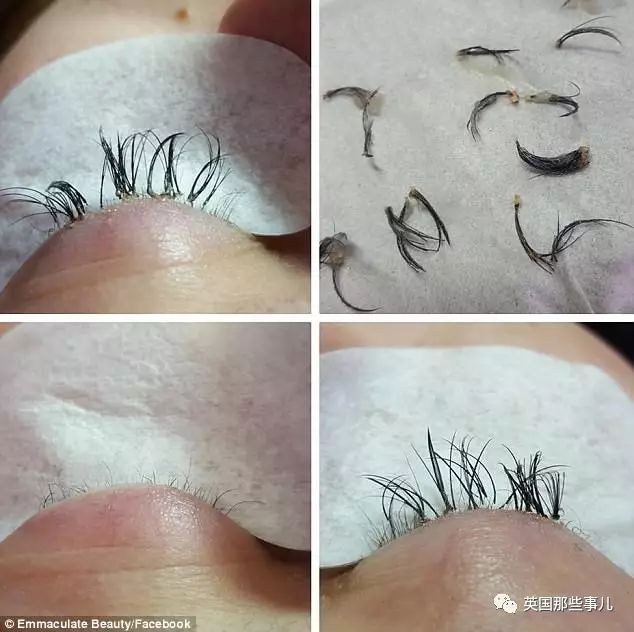 她想植人工睫毛，却搞到自然睫毛全掉光……看到这一切，连植睫专家都忍不住了