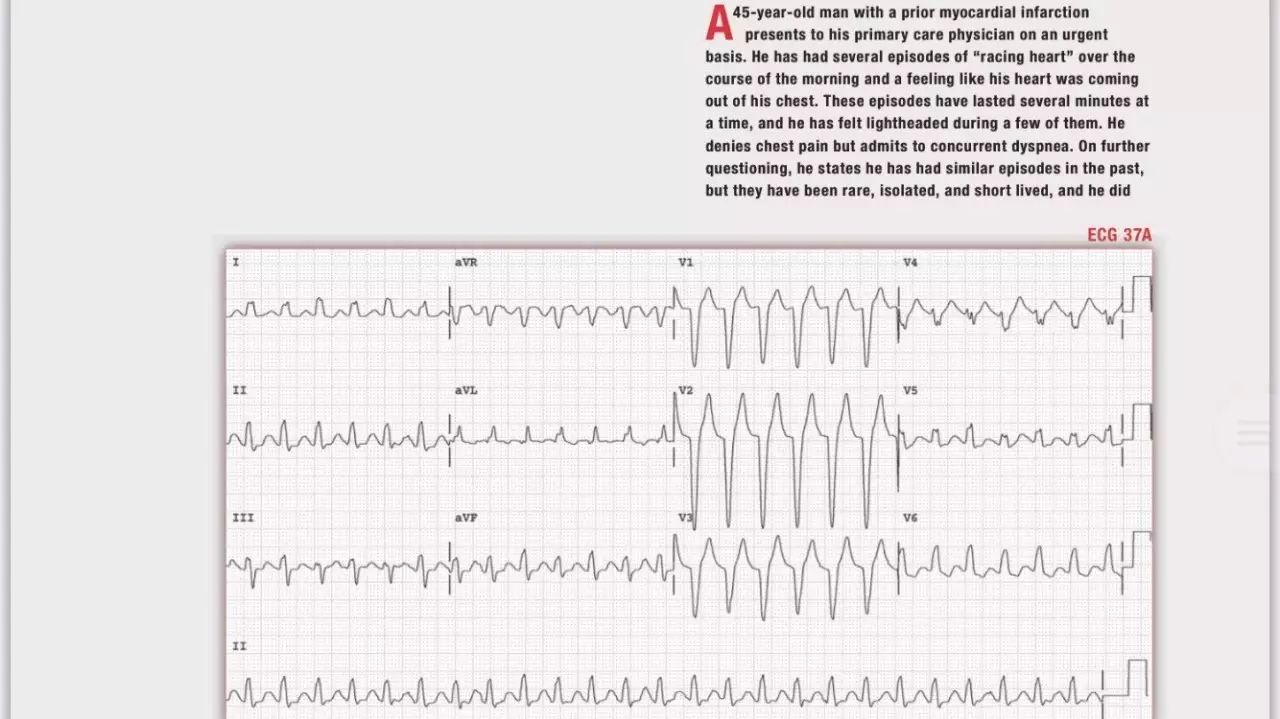 读心有术205期视频,读心有术