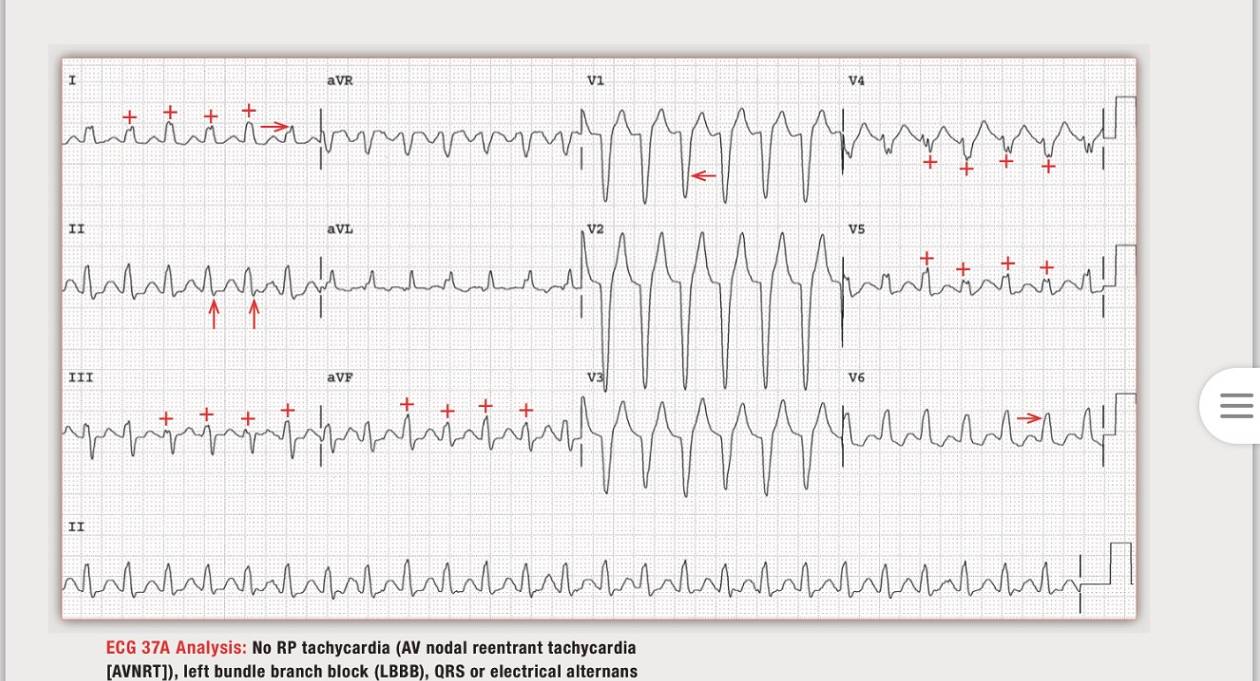 读心有术100期,读心有术171