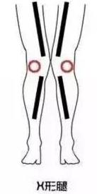 男士腿不直适合穿什么样的裤子,大腿粗腿短的女生适合什么裤子