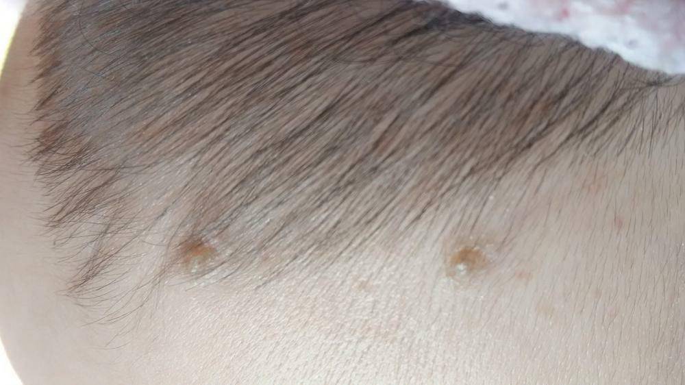 产后宝妈贫血怎样调理,月经不调贫血怎么调理才能补上来