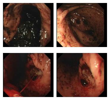 消化内镜都是消化内科医生做的吗,消化内科医生做内镜吗