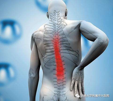 世界镇痛日|痛痛痛!这几种疼痛竟然祸起腰椎!