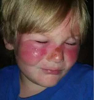 防晒霜哪个牌子的好用不伤脸,什么牌子防晒霜好用不伤脸