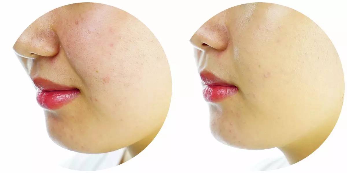 大牌粉底和平价粉底有什么区别,平价粉底和大牌粉底差距在哪里