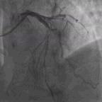 典型病例及处理方法,典型病例分析及治疗方法