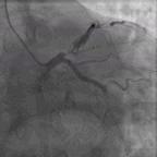 典型病例及处理方法,典型病例分析及治疗方法