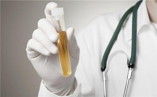 怀孕尿检什么指标,尿检指标科学解读