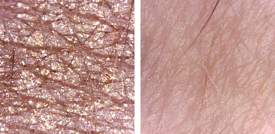 美容院提拉效果最好的美容仪器,好的美容仪器的作用