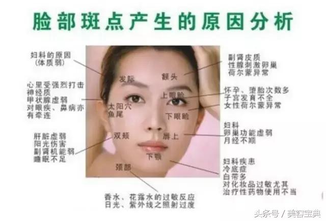 祛斑攻略各类色斑问题解决,祛斑先识斑辨证治斑方法多