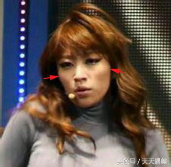 王思聪签的韩国女团EXID不承认整容，还做CT，被网友啪啪打脸！