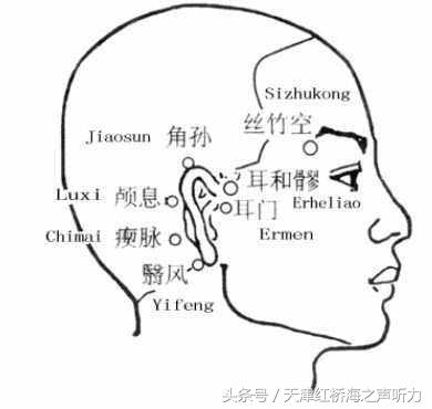 耳聋耳鸣针灸有效果吗,中医针灸治疗耳鸣效果怎么样